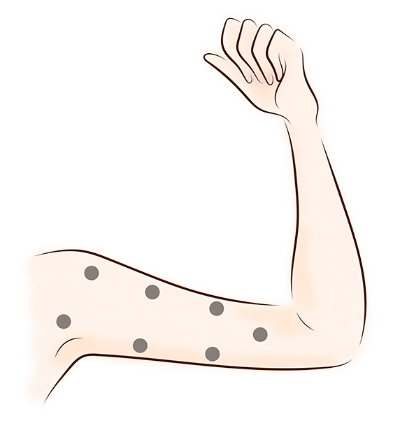 腕