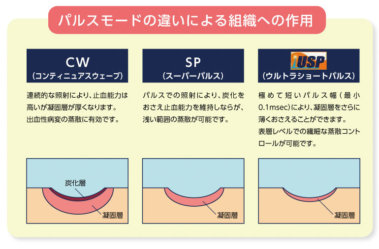 パルスモードの違いによる組織への作用