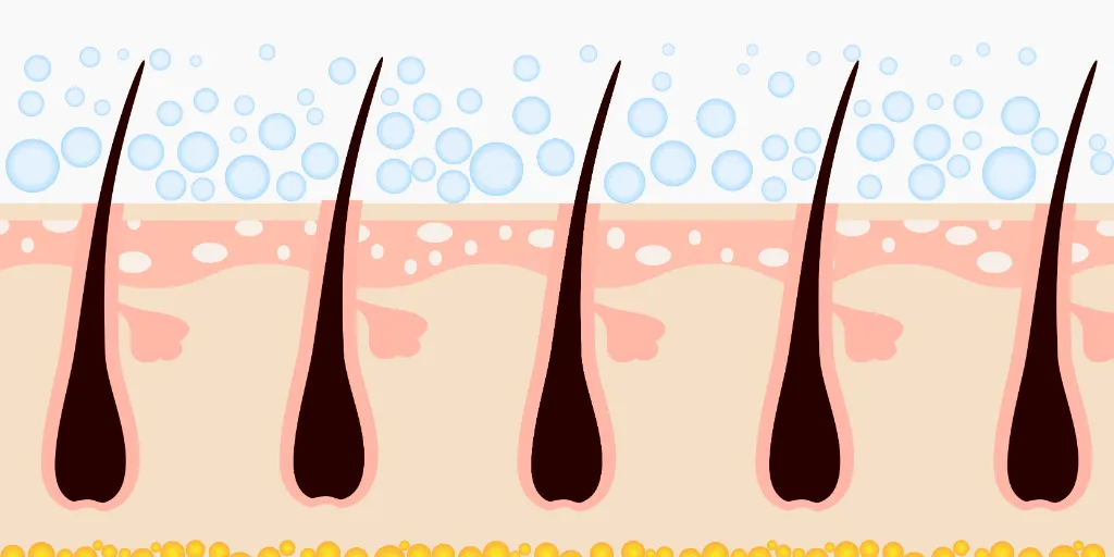 毛根イラスト
