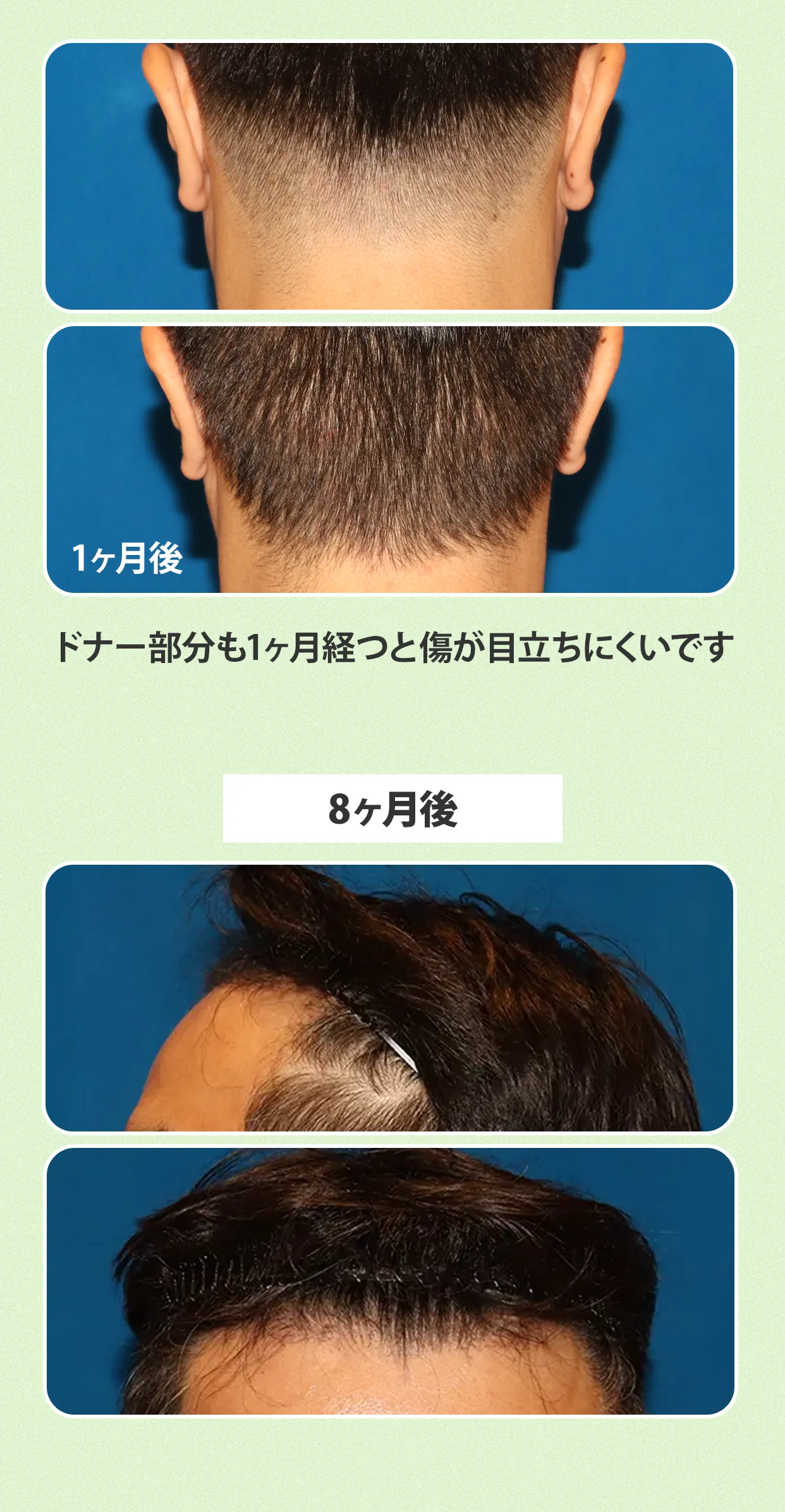 施術例