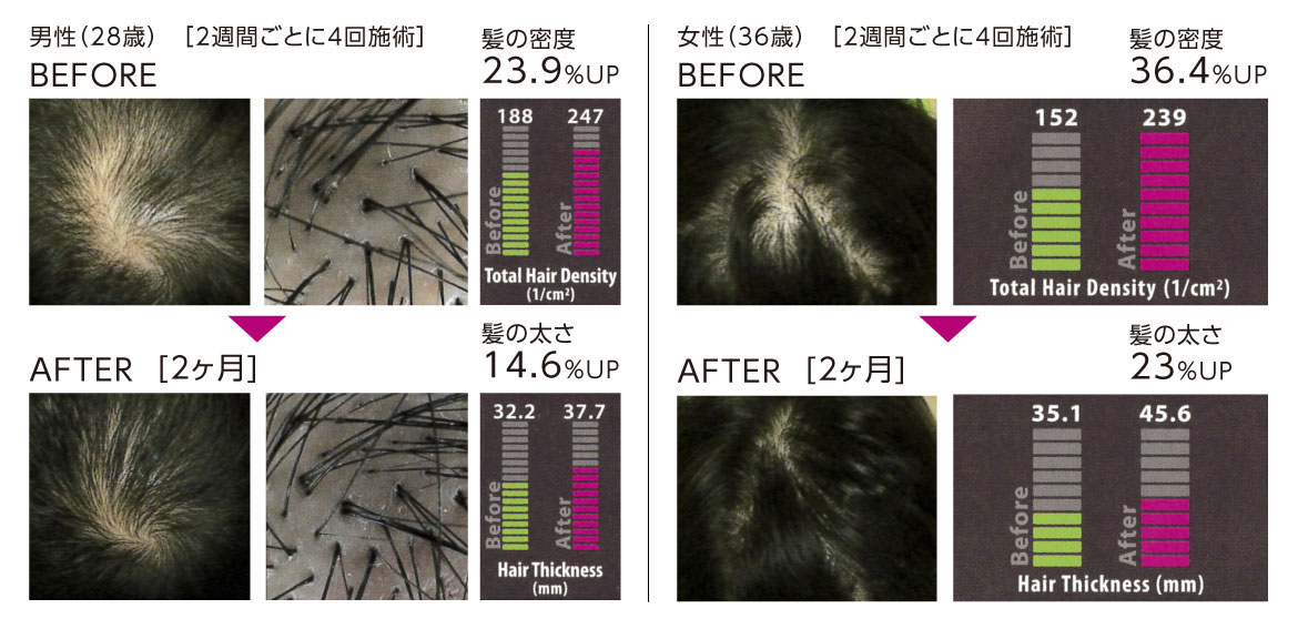 Hair Growth Illustration
