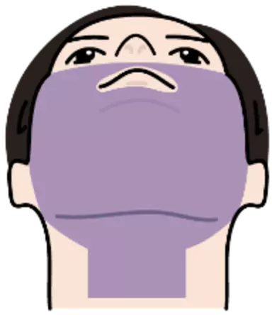 Hair Loss Range Upward Image