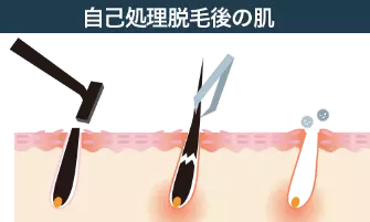 Treatment 1