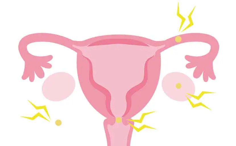 子宮外妊娠とは？