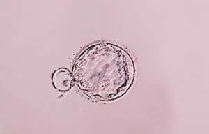 体外受精で妊娠する確率は？