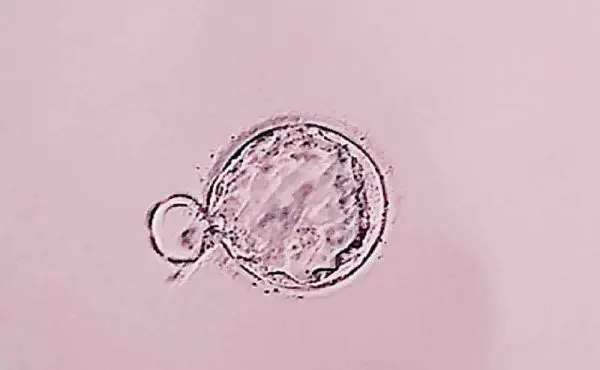 体外受精で妊娠する確率は？