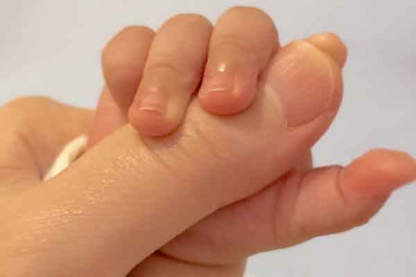 2q37.3欠失症候群の症状